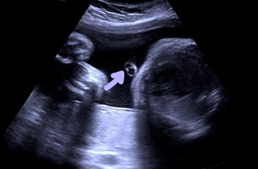 图片 3.png 图片 3.png