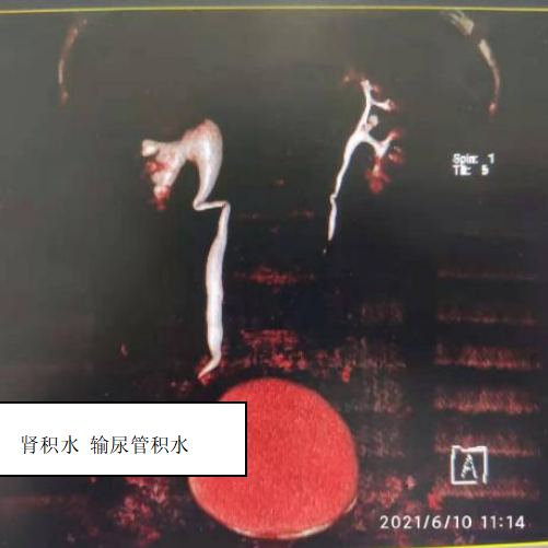 微信截图_20210714162041.png 微信截图_20210714162041.png