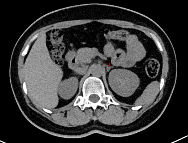 图片 2.png 图片 2.png