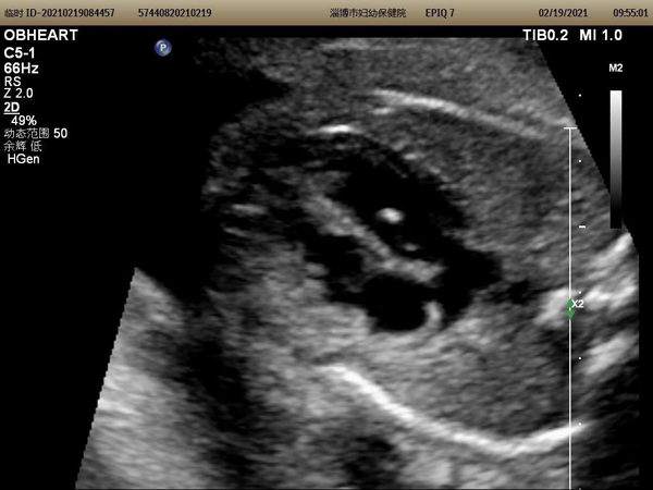 图片 1.png 图片 1.png