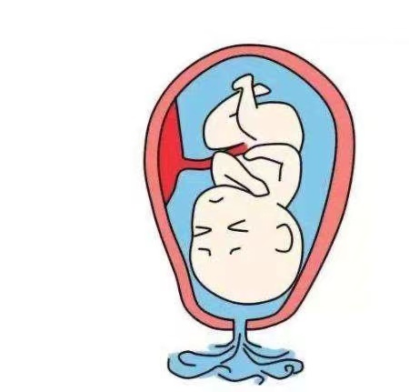 32d46a45f4ec705d0e0b0098546b79f.jpg 32d46a45f4ec705d0e0b0098546b79f.jpg