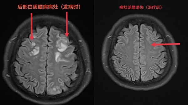 图片 1.png 图片 1.png