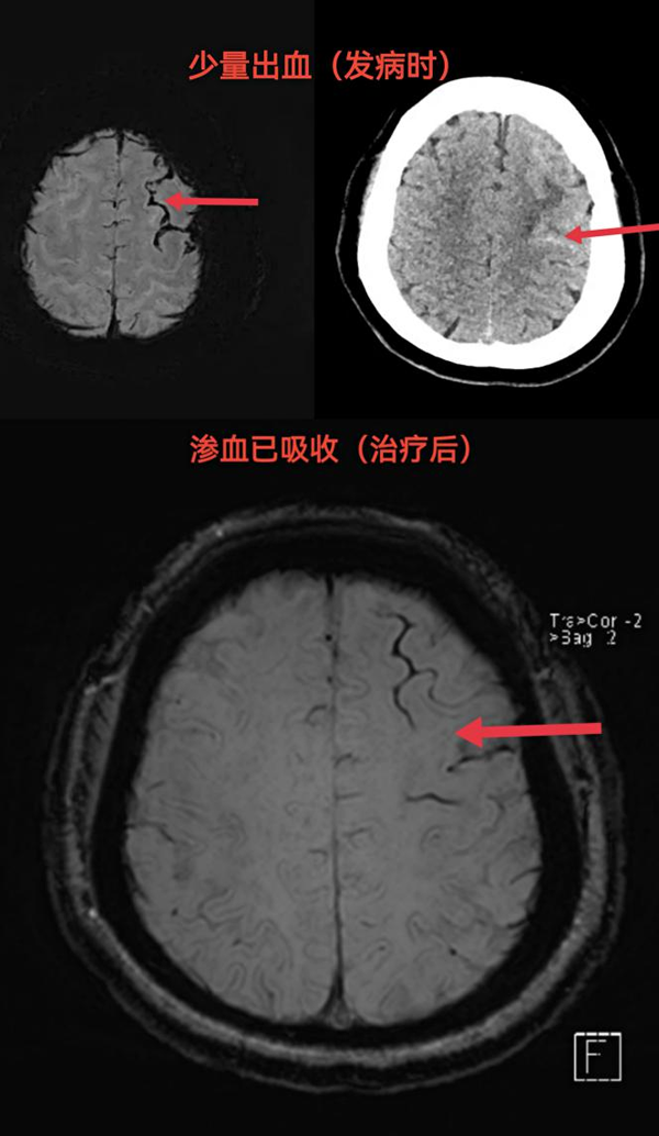 图片 2.png 图片 2.png