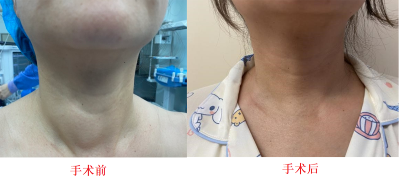 图片11.png 图片11.png