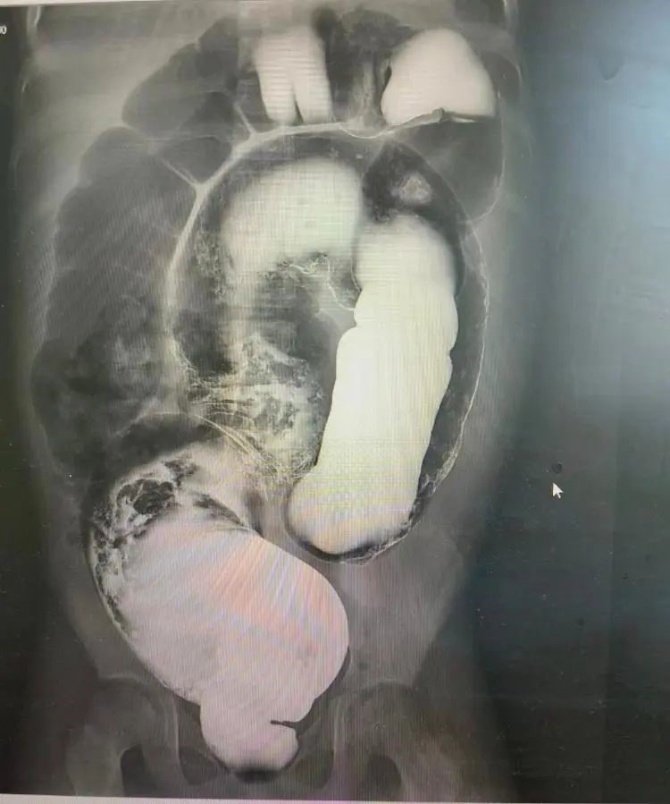 202405062308536719.jpg 202405062308536719.jpg