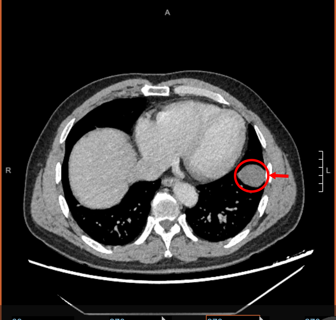 图片33.png 图片33.png